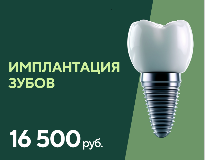 Акция Имплантация!