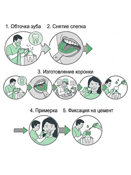 Установка коронки на зуб